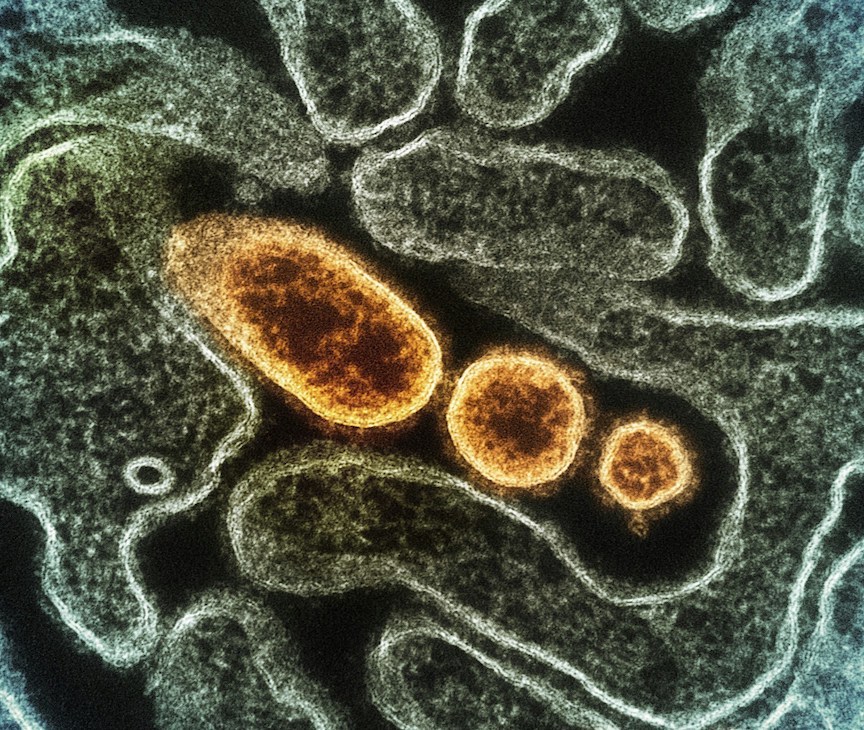 allergy and infections